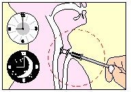 larynx007